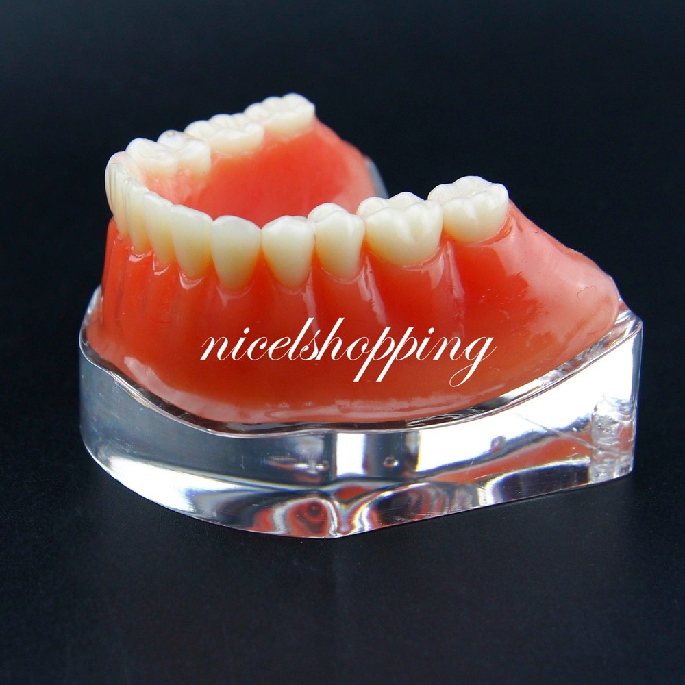 Dental Inferior Overdenture Model Lower Precision Implants With Silver Bar #6009