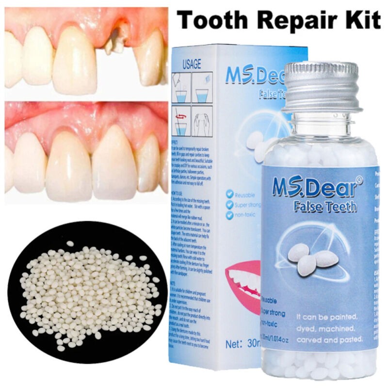 Tooth Repair Kit -Temporary Teeth Replacement Kit for Missing & Broken Teeth