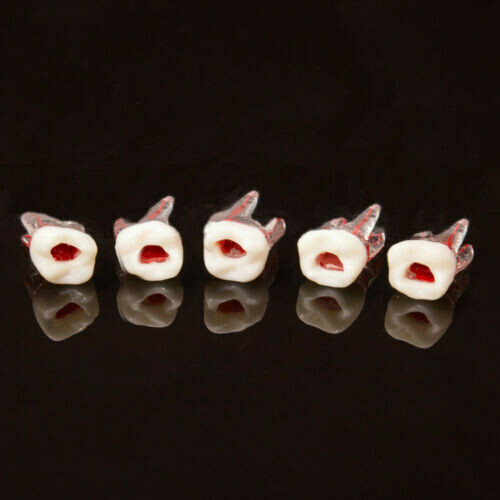 5Pcs Dental Tooth Endo Root Canal Study Model For RCT Practice Block Pulp Cavity
