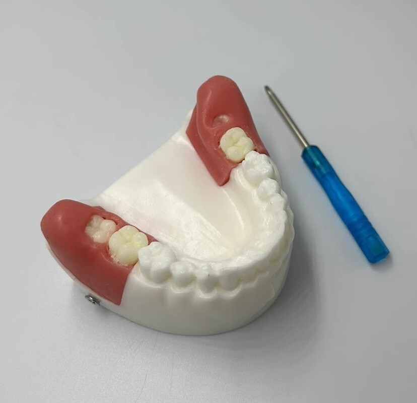 Dental Impacted Tooth Extraction Practice Model Dental Training Display