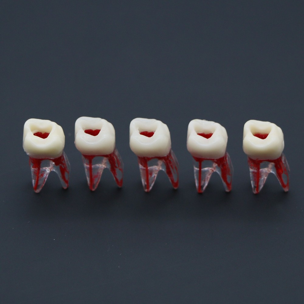 Dental Typodont Endodontic Practice Pulp-Opened RCT Root Canal Teeth Model M8008