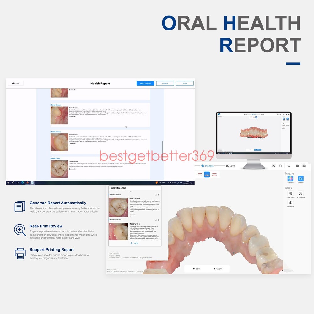 Dental Digital Impression Intraoral 3D Scanner Scanning Software CAD/CAM Process