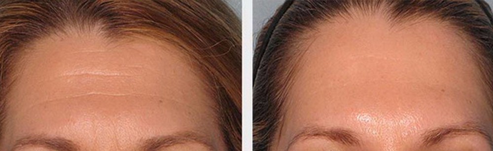 DIY 100% Argireline Copper Peptide Solution Booster + Matrixyl 3000, SNAP-8,