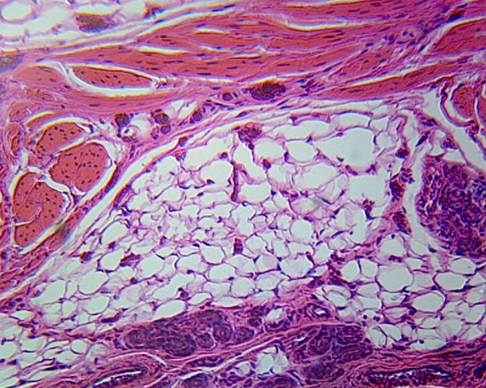 Human Skin; Cross Section