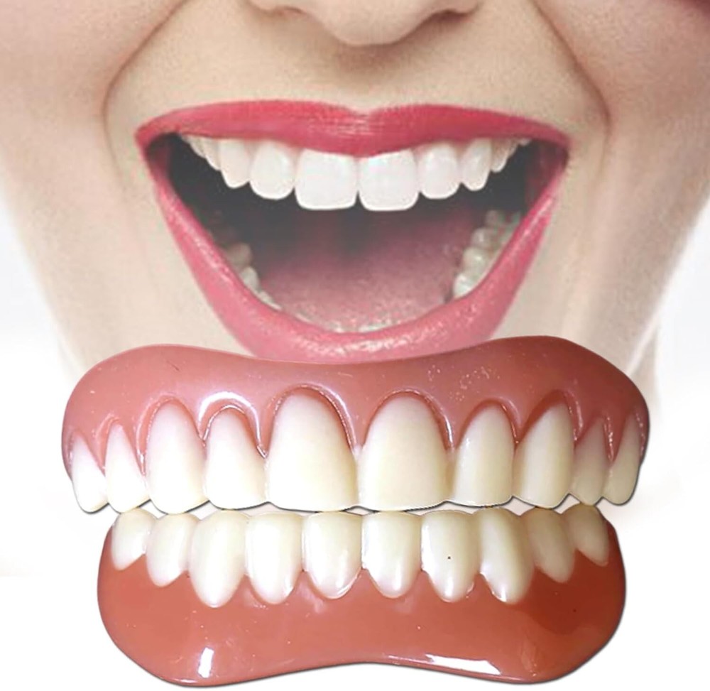 Instant Smile Natural Shade Complete Teeth Makeover Kit, Upper & Lower Veneers