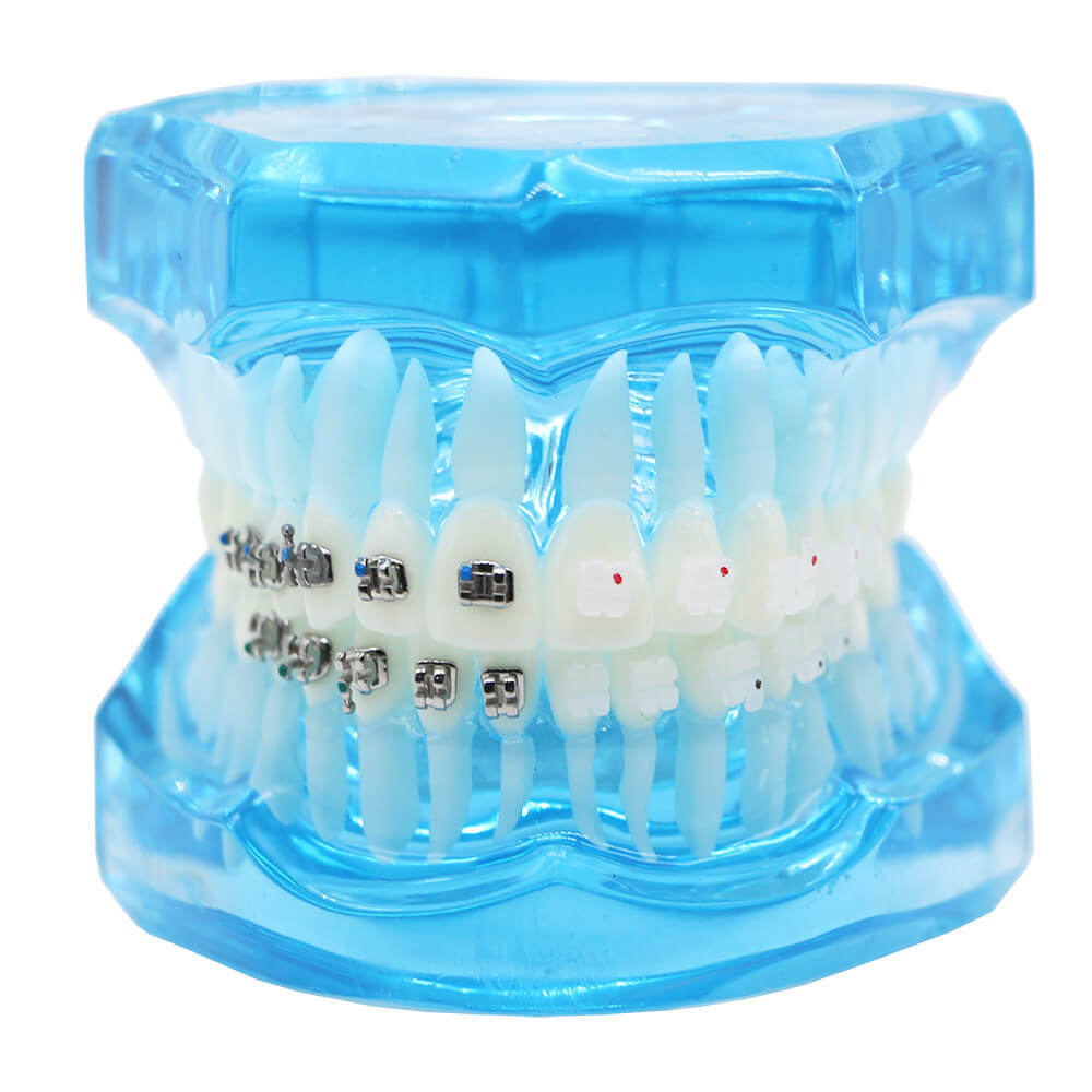 Dental orthodontic contrust teach study teeth model mental and ceramic bracket
