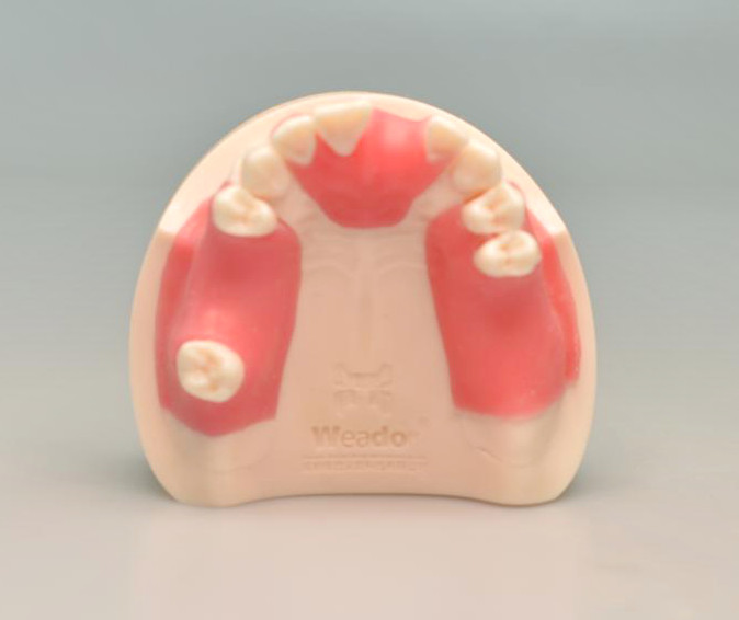 Dental Planting Replacement Module/maxillary&mandibular Implant Model Dentistry