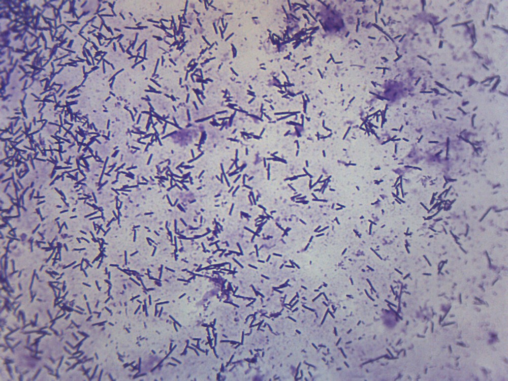 Escherichia Coli Smear, Prepared Microscope Slide - 75x25mm - Eisco Labs
