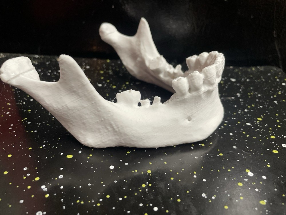 3D PRINTED HUMAN 3d JAW BONE
