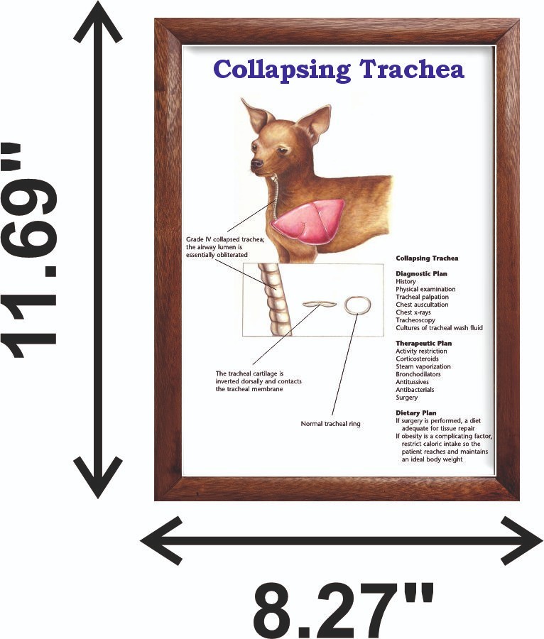 Collapsing Trachea Chart 12x18 inches