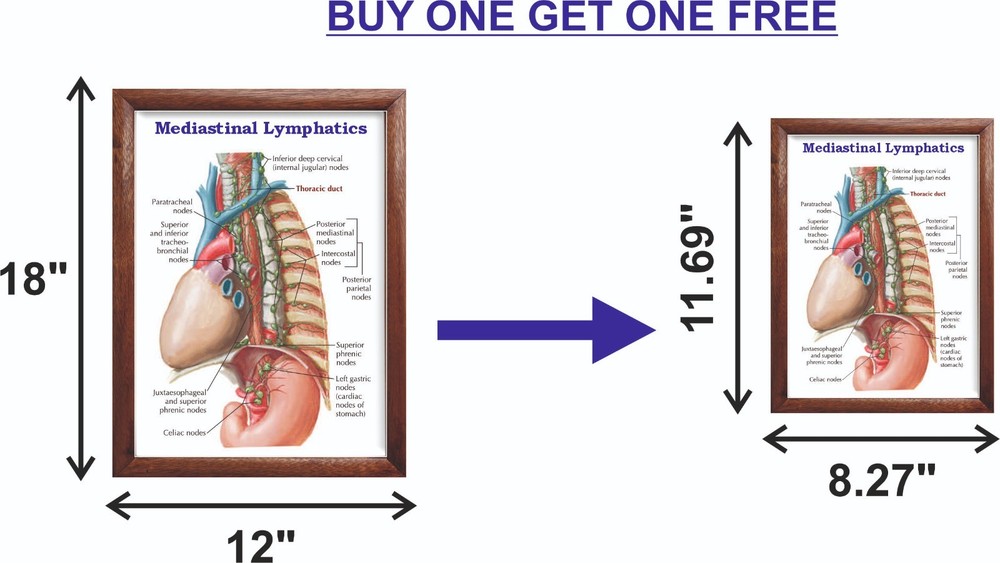 Mediastinal Lymphatics Chart 12x18 inches