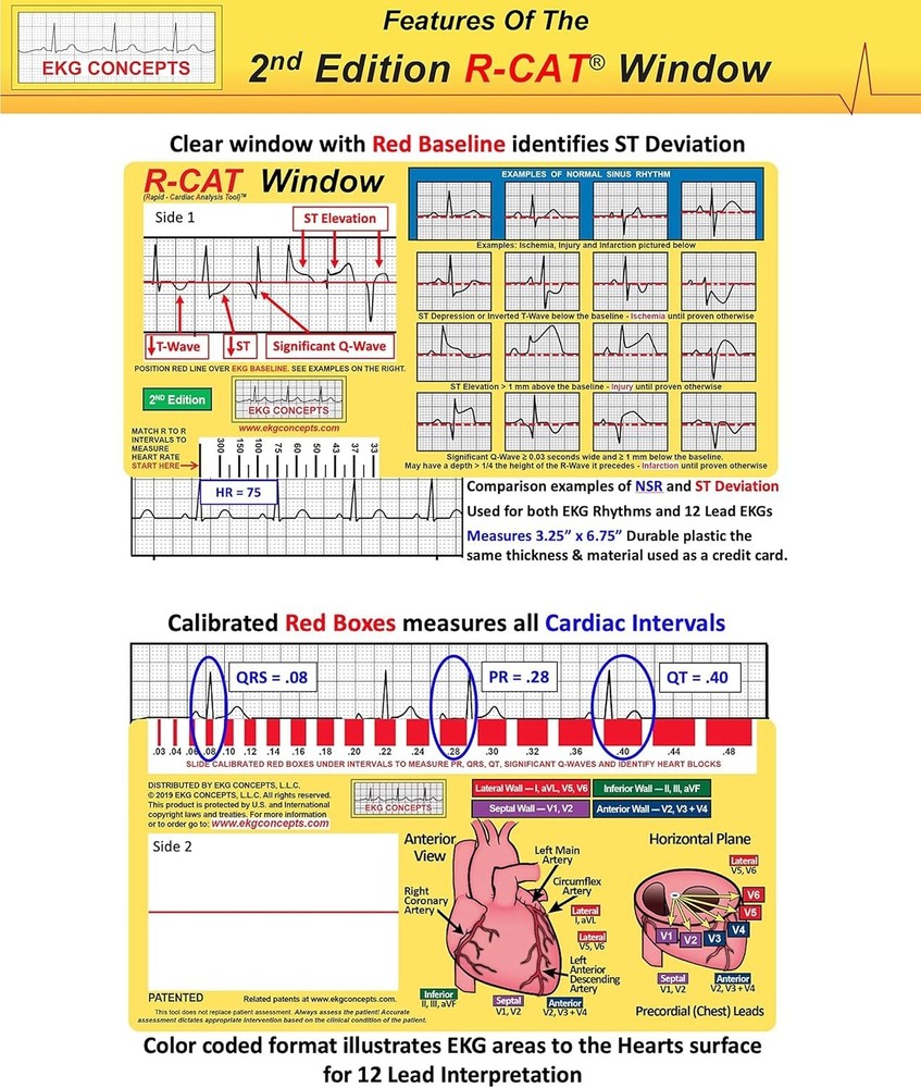 EKG Window 2nd Edition