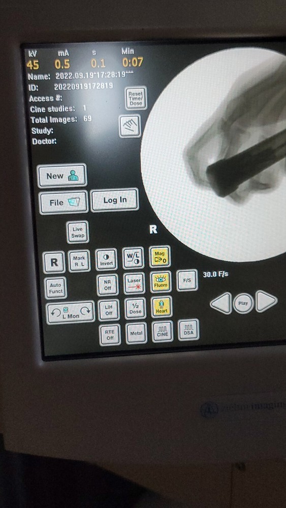c-arm pain management