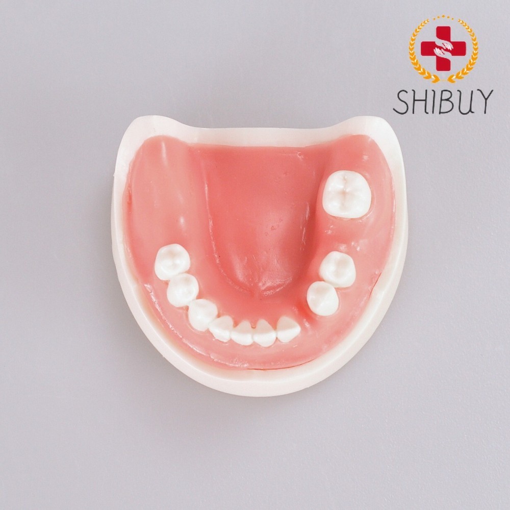 Dental Teeth Missing Implanting Typodont Training Dentistry Model Display