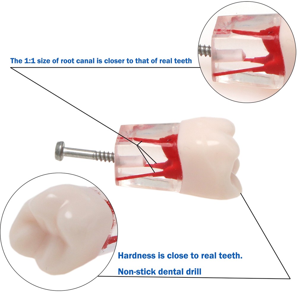 10Pcs Dental Root Teeth Canal Pulp Cavity RCT Endodontic Practice Teeth Model