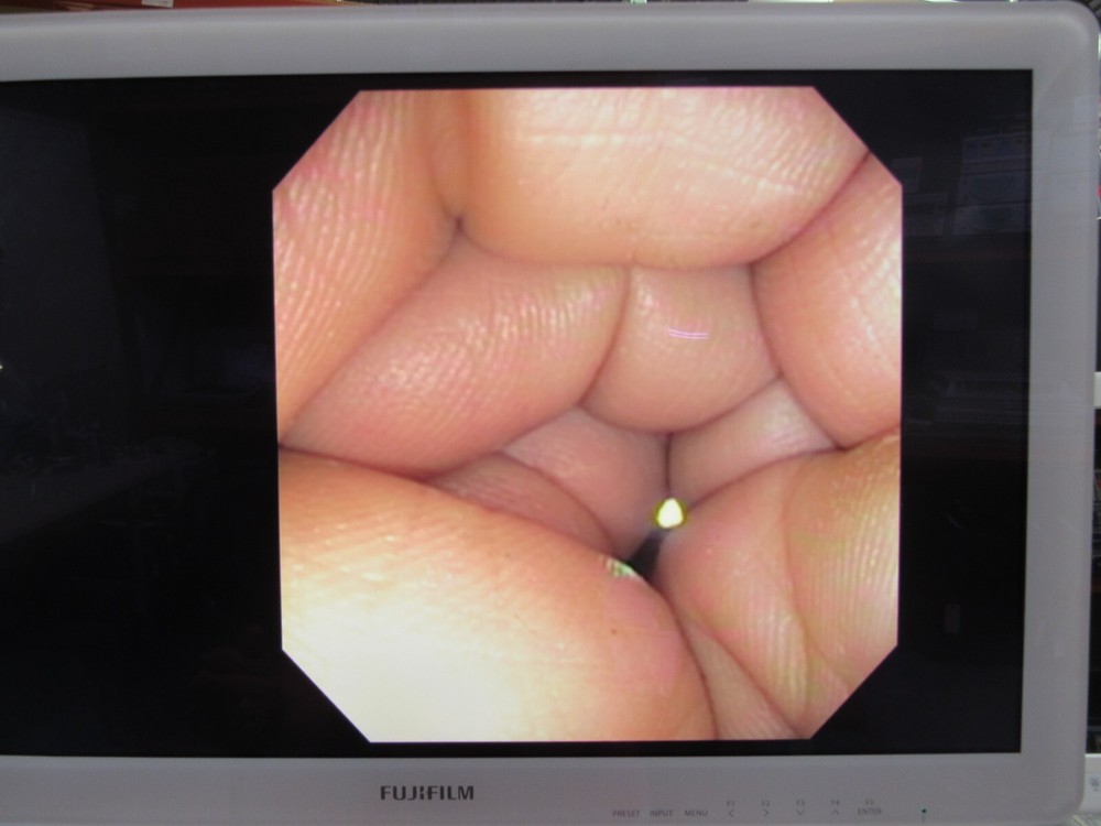 Olympus CF-140S Sigmoidoscope Endoscopy Endoscope #2