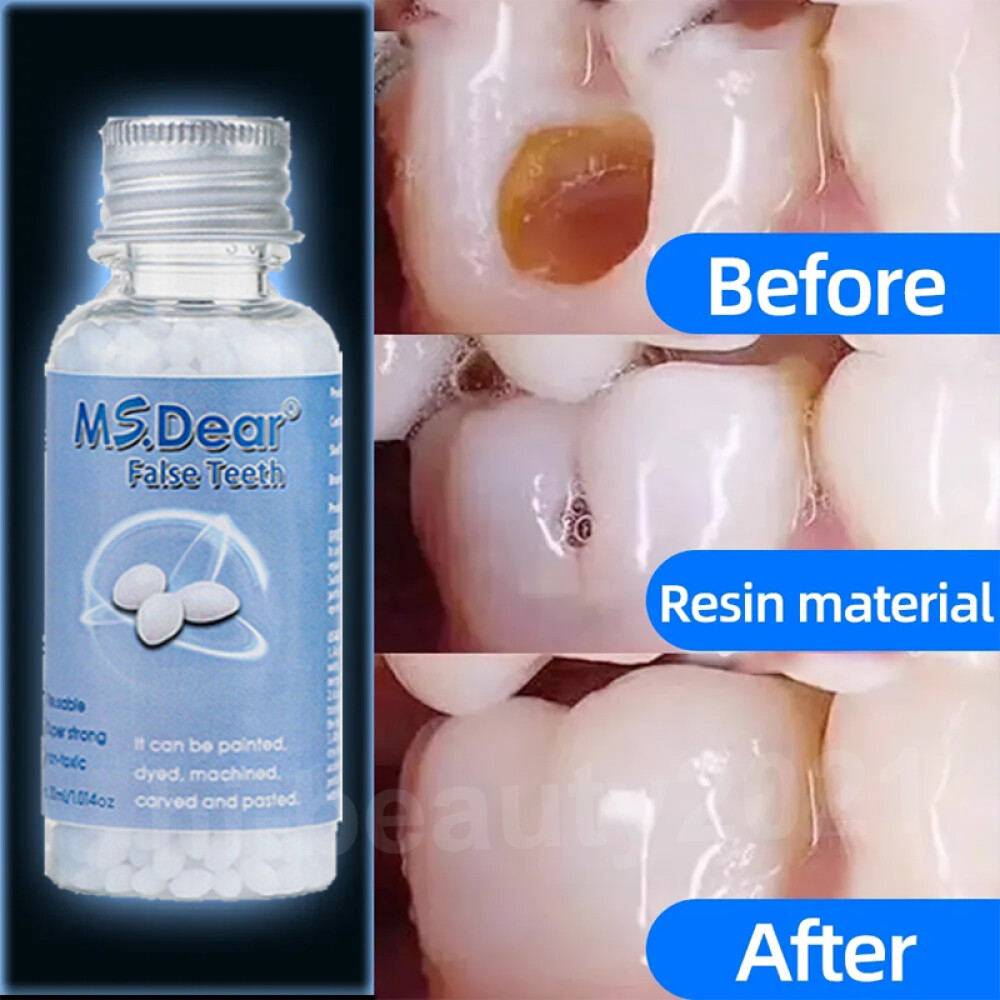 Tooth Repair Granules Temporary Kit Fitting Beads Reusable Moldable False Teet