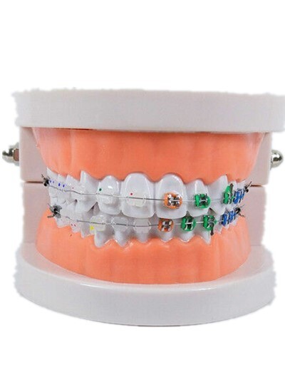 1 Pc Dental Orthodontic Demonstration Ceramic Bracket Typodont Study Model Metal