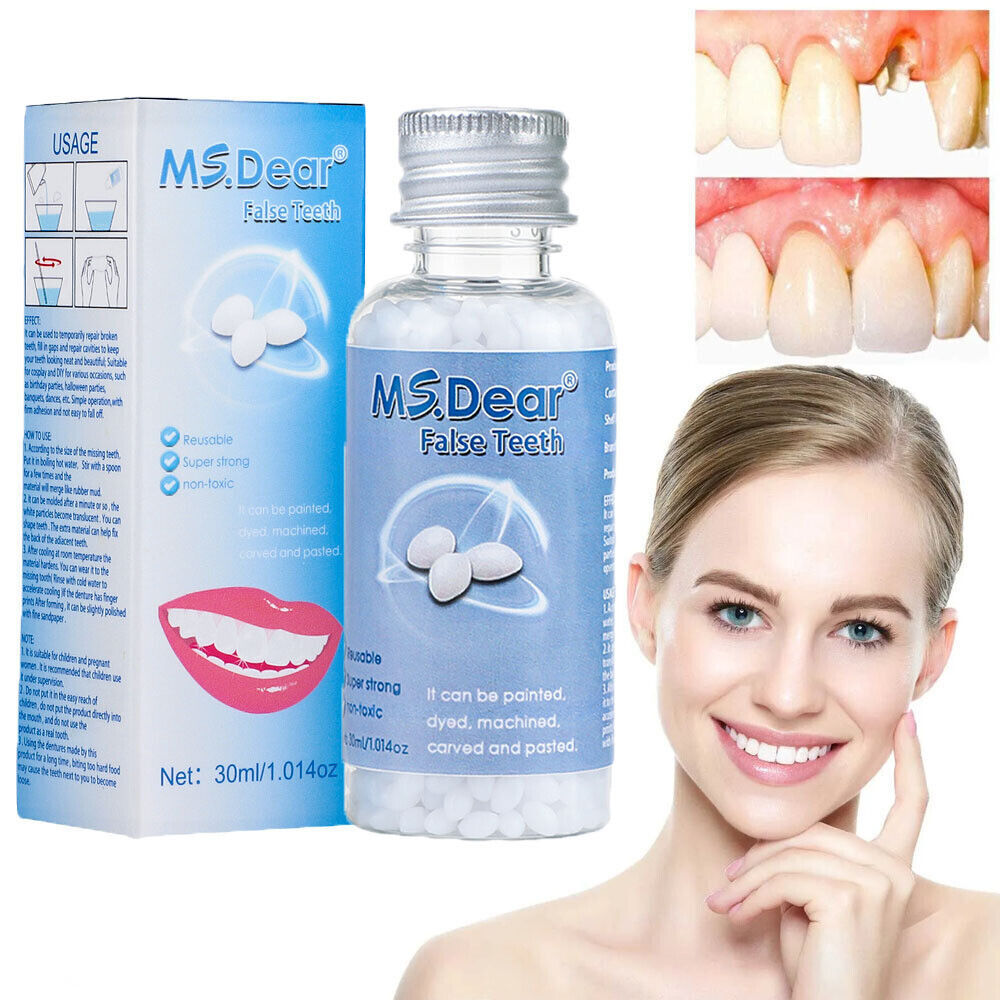 2× Resin False Teeth Solid Glue Temporary Tooth Gap Filler Tooth Repair Moldable