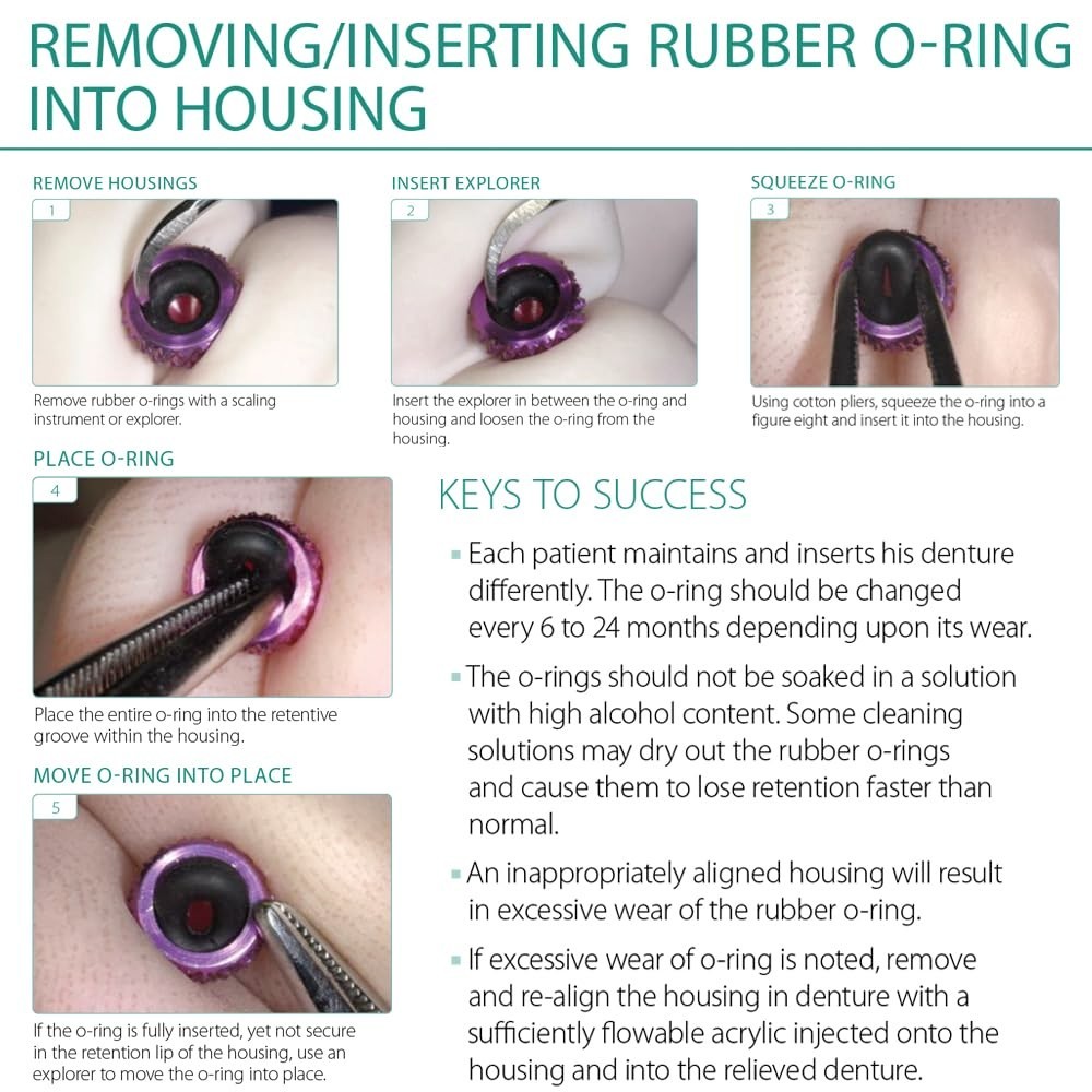 MDLMOR10Z MDLORZ Replacement O Ring Kit, for Intralock Mini Implant Metal