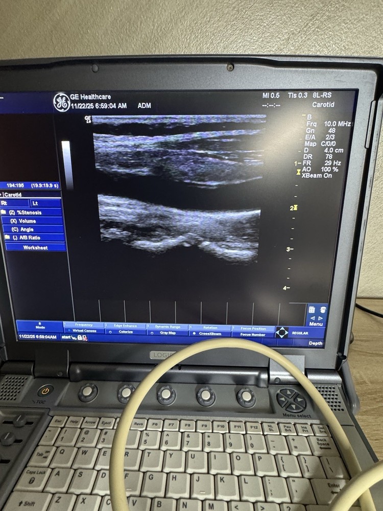 GE 8L-RS Liner Array Ultrasound Probe Transducer