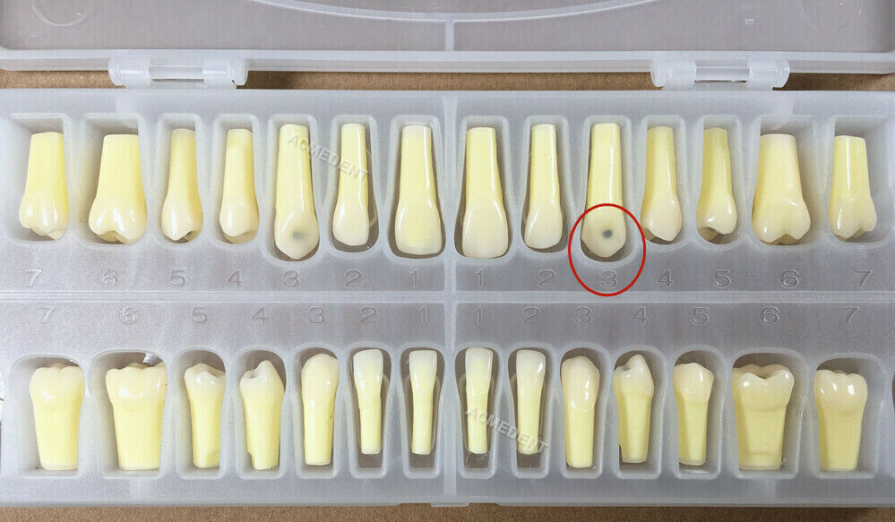 Dental Caries Remove Teeth Decayed Removing Practise Model Dentist Student Test
