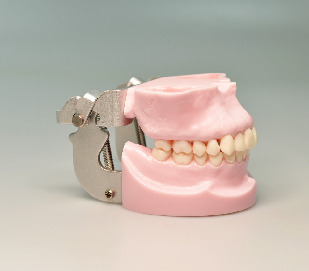 Dental Typodont Orthodontic Model Teeth Anchorage Implant Training Practice