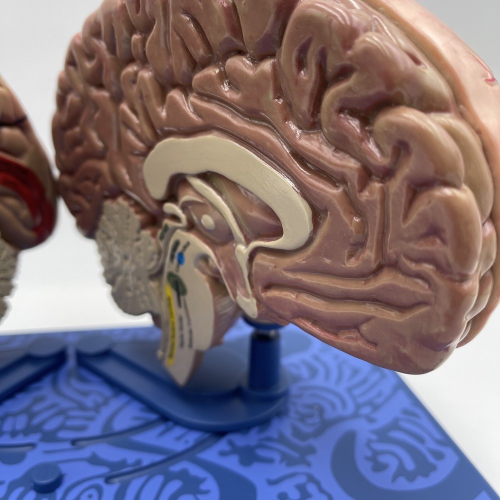 Maxalt Brain Anatomical Model Migraine Pathology Education Teaching Model
