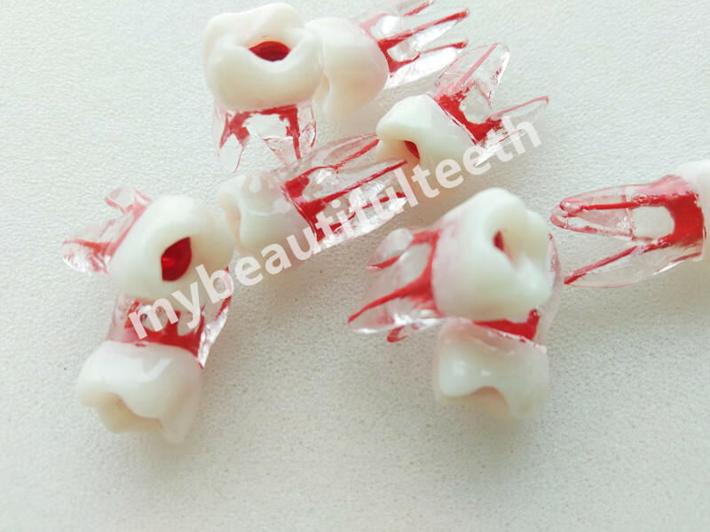 Dental Tooth Endo Root Canal Study Model RCT Practice Block Pulp Cavity