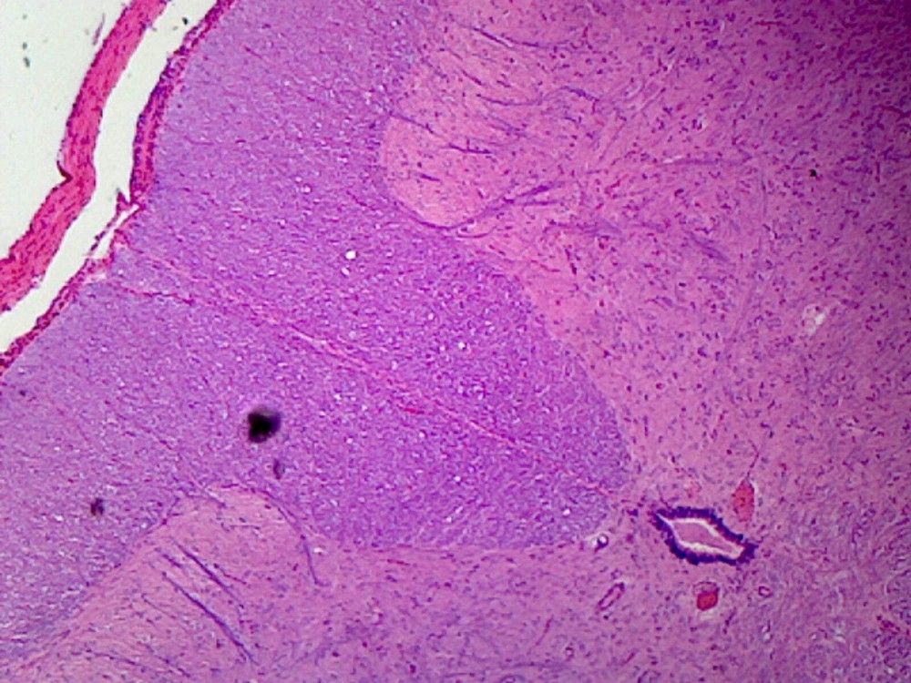 Spinal Cord; Cross Section
