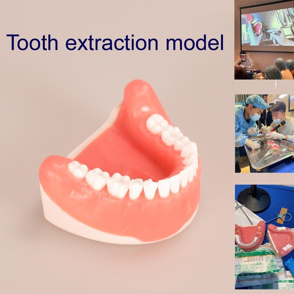 Maxillary+Mandibular Tooth Extraction Practice Model Dental Typodont Display