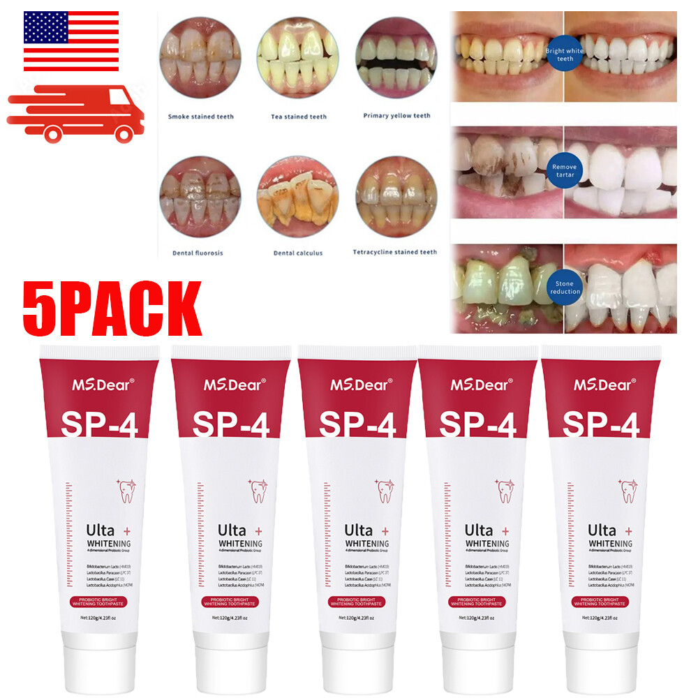 5PACK Toothpaste, Whitening Sp-4 Toothpaste, Sp-4 Probiotic Whitening Toothpaste