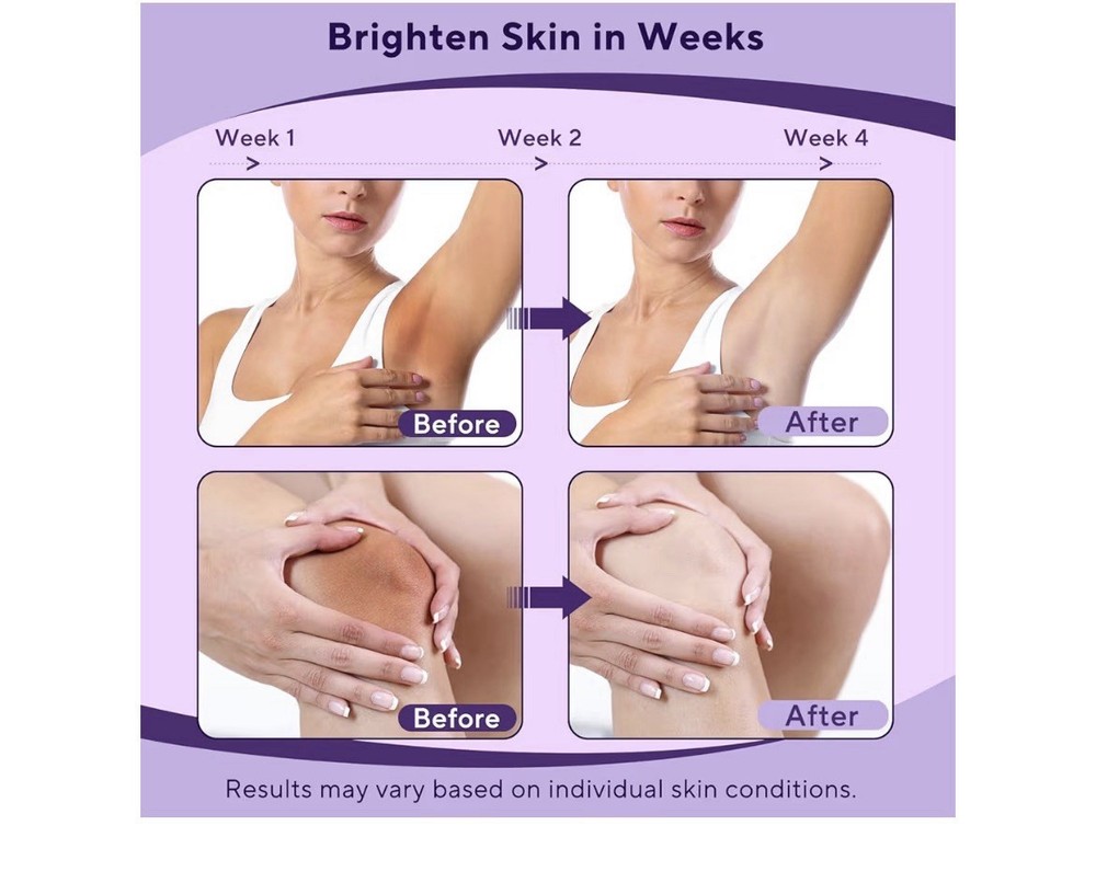 Skin Bleaching Cream