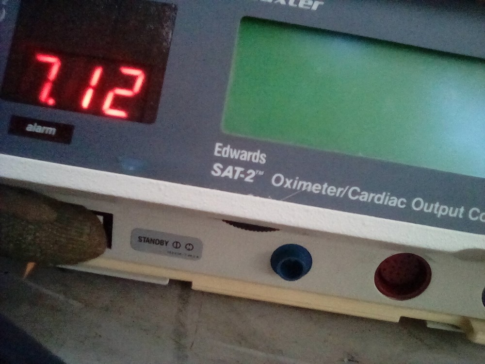Baxter Edwards SAT-2 Oximeter/Cardiac Output Computer