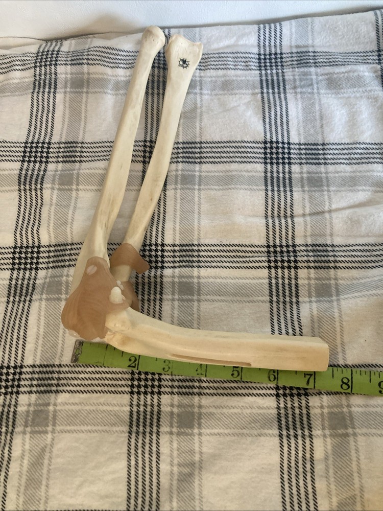 Somso Anatomical Elbow Joint Model. Read