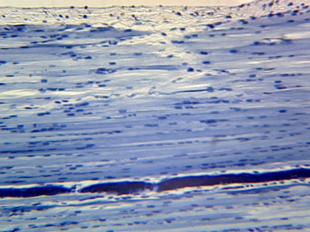 Skeletal Muscle, Human; Longitudinal Section