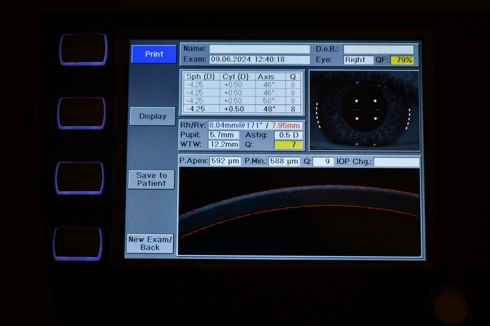 Oculus PARK 1 Autorefractor Keratometer pachymetry