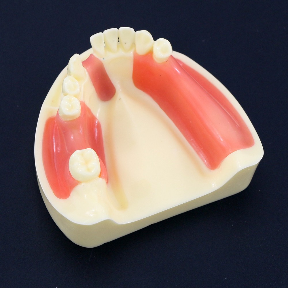 Dental Teeth Model Gingiva Removable Implant Drilling Practice Teeth Model M2004