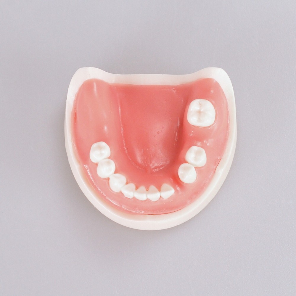 Dental Teeth Missing Implanting Typodont Training Dentistry Model Display