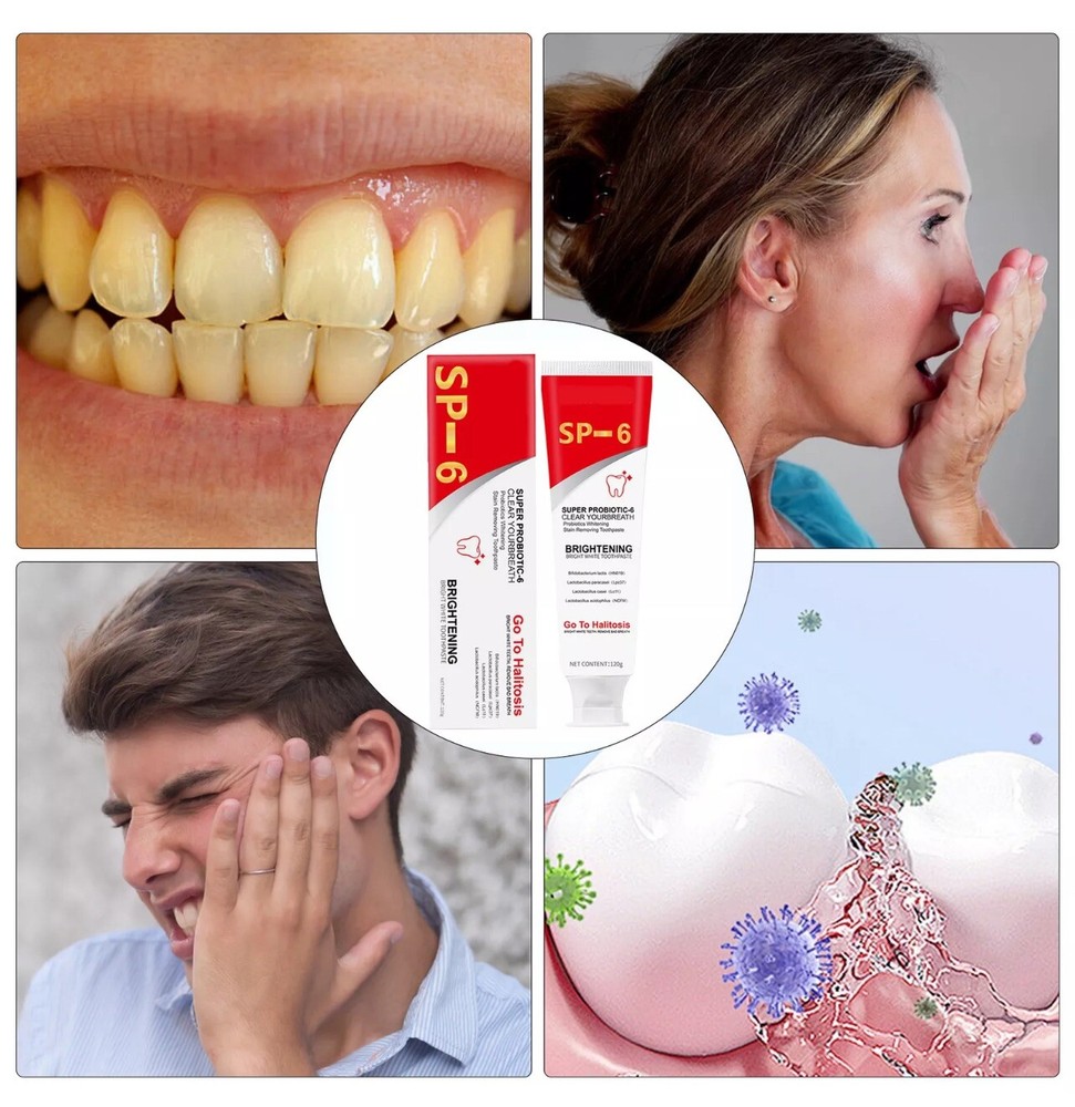 2Pcs Super Probiotic SP-6 Toothpaste, Probiotics Bright White Toothpaste, Sp 6