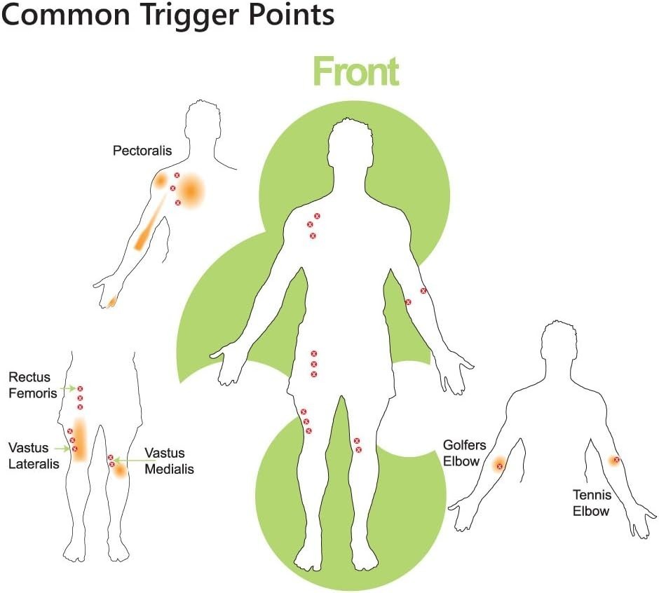 DISLockeroom Pocket Physio Ma rigger Triangle Pressure Point Release