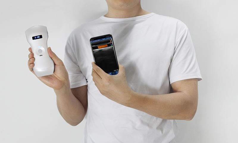 192 Elements convex/linear/phased array 3 in 1 Doppler Ultrasound Scanner