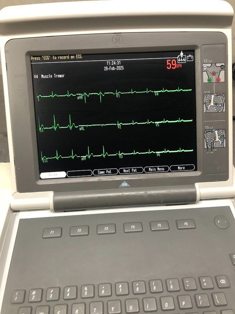Marquette MAC 5000 Resting ECG Analysis System