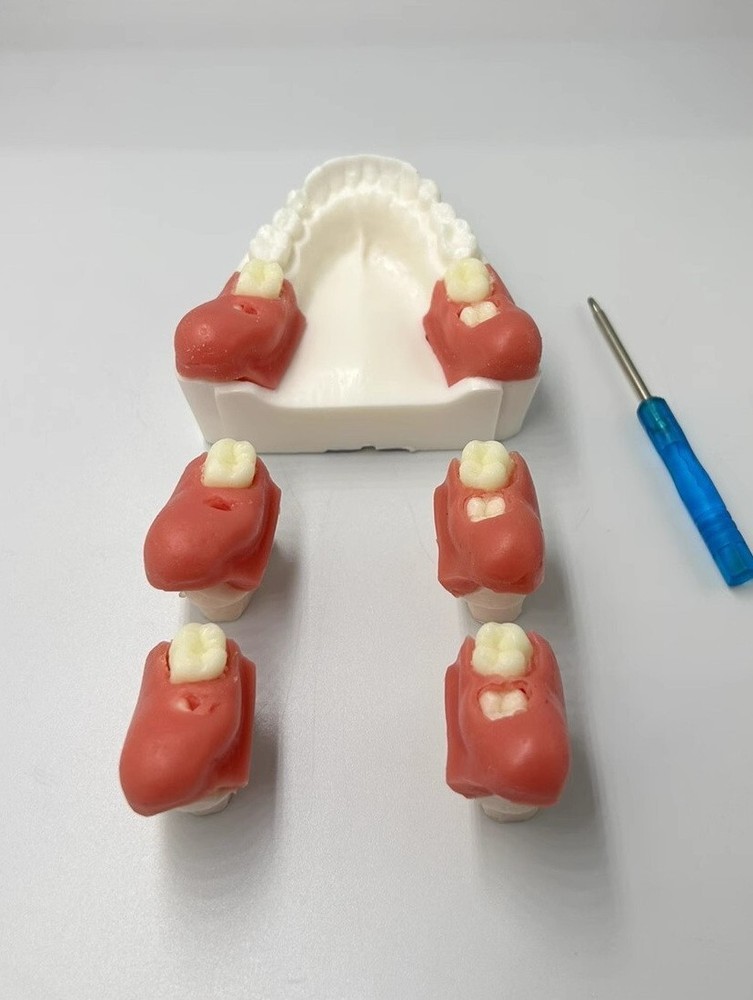 Dental Impacted Tooth Extraction Practice Model Dental Training Display
