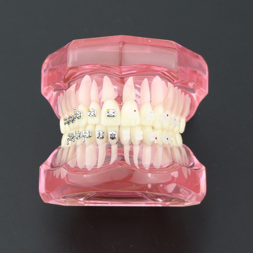 Dental OrthodonticCeramic Brackets 3003 Teeth Study Treatment Model With Metal