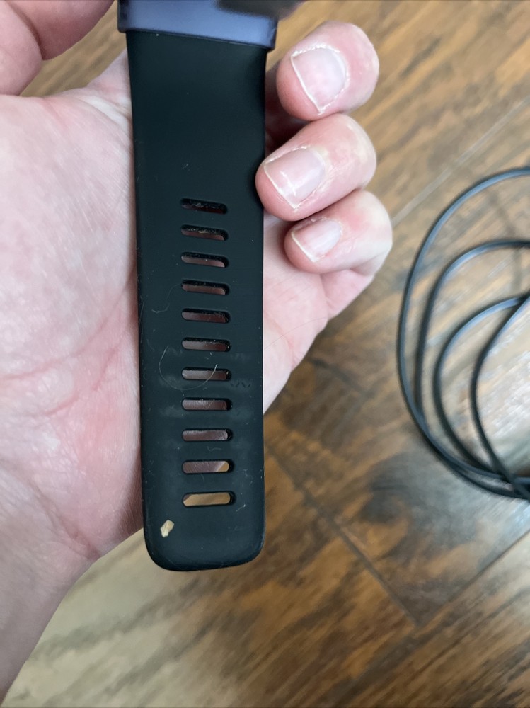 Fitbit Surge Wristband Activity Tracker Doesn’t Hold A Charge. With Charger