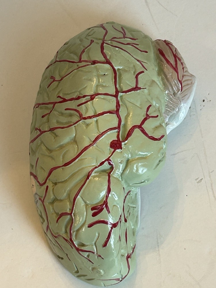 Bobbitt Laboratories Anatomical Half Head Model Removable Brain Vintage