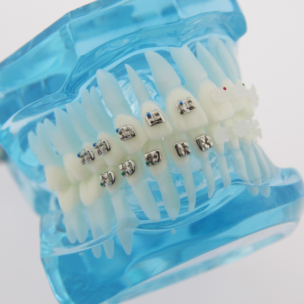 Dental Teach Study Typodont Teeth Model Half Metal Bracket Half Ceramic Bracket