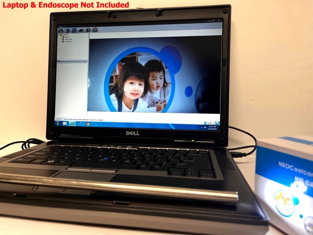 Rigid Endoscope Nasoscope Sinuscope ENT HD USB Camera Head+Coupler+Light Source