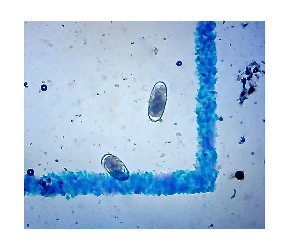 Bundle of 2 McMaster Method Microscope Slides, FEC (Fecal Egg Count) Double C...